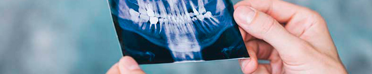 Рентген зубов на Бауманской